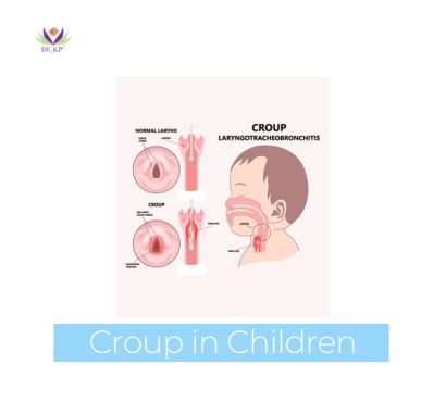 Croup in Children: Causes, Symptoms & Treatment