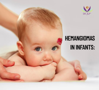 Hemangiomas in Infants: Causes and Treatments