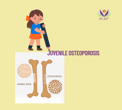 Juvenile Osteoporosis in Kids India: Causes Symptoms Diagnosis