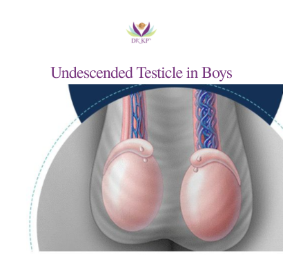 Undescended Testicle in Boys: Causes, Symptoms & Treatment