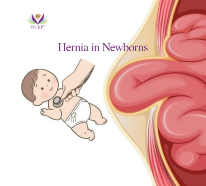 Hernia in Newborns
